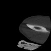 SPORK, NICO - 22.03.1976 - 02.08.2022 - CT obere Extremität - 17:51:17